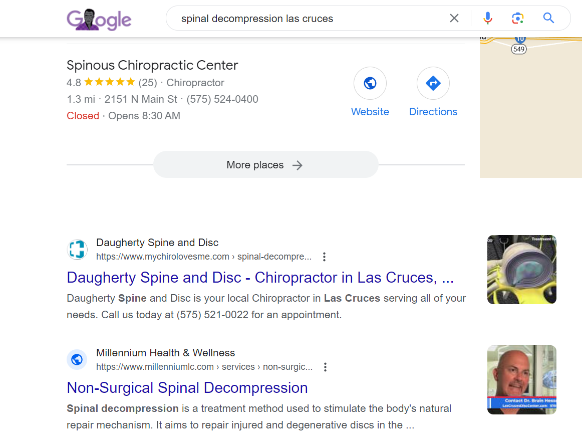 Google SERP for spinal decompression keyword